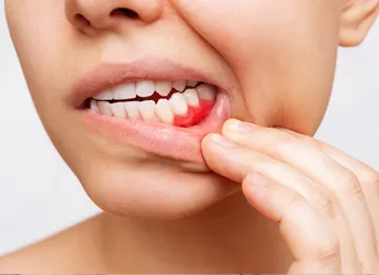 Woman experiencing gum pain and swelling