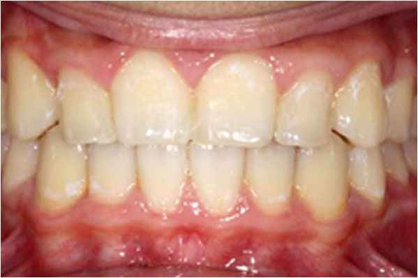 Orthodontics After Orthodontics After