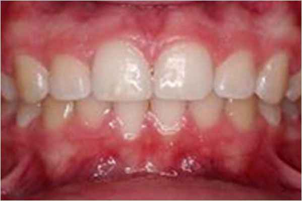 Orthodontics After Orthodontics After