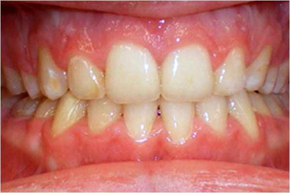 Orthodontics After Orthodontics After