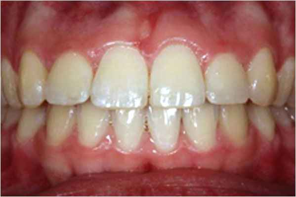 Orthodontics After Orthodontics After