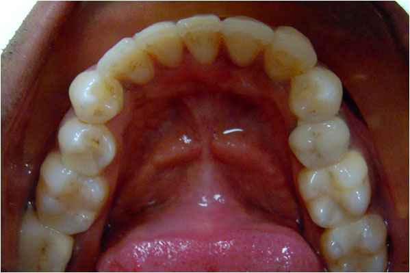 Orthodontics After Orthodontics After